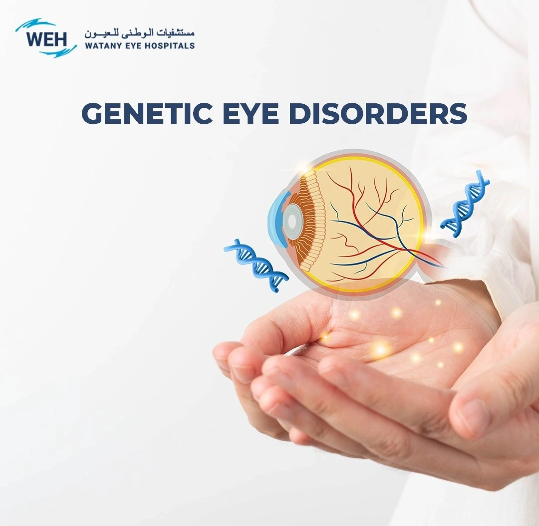 Genetic Eye Disorders | Watany Eye Hospitals