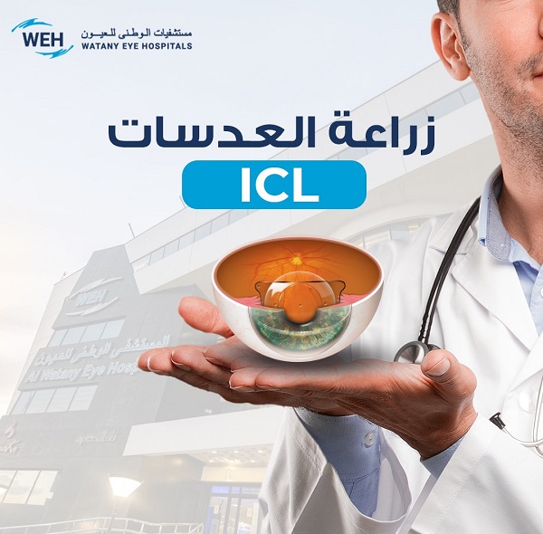 زراعة العدسات ICL