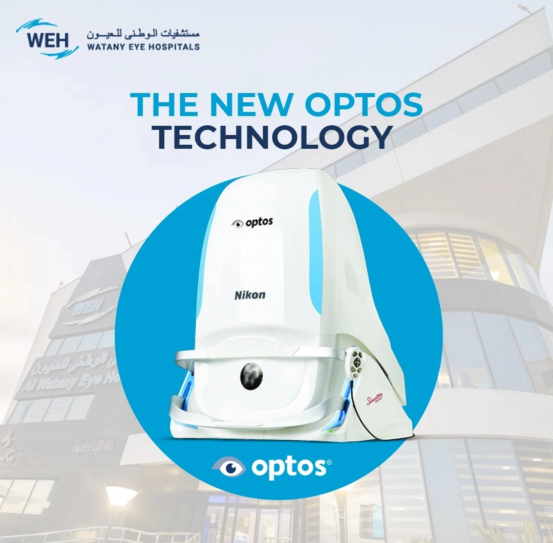 Optos | Watany Eye Hospitals