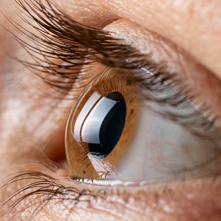 Cornea and External Eye Diseases