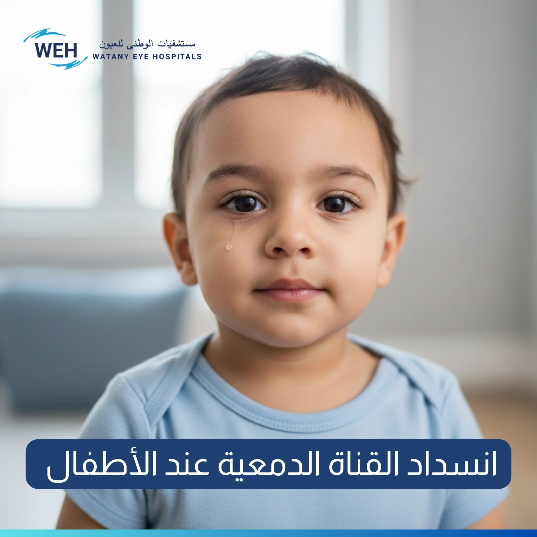انسداد القناة الدمعية عند الأطفال