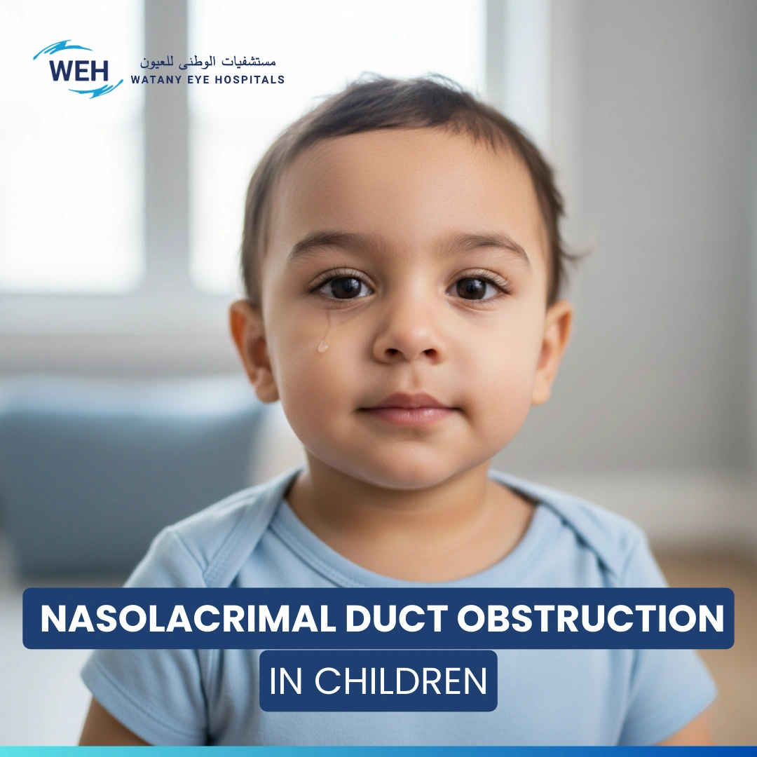 Nasolacrimal Duct Obstruction in Children: A Full Guide