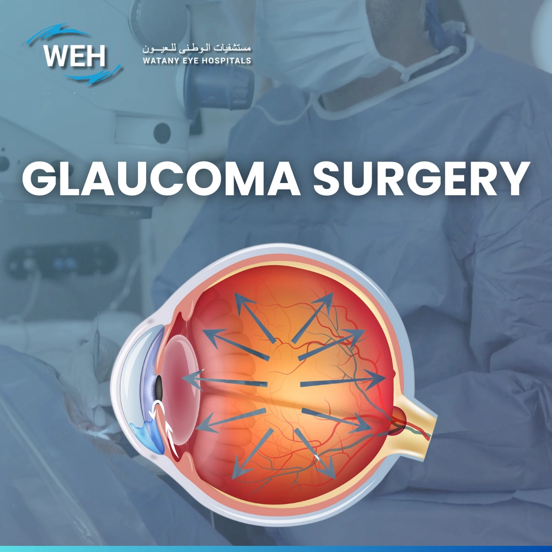 Glaucoma Surgery