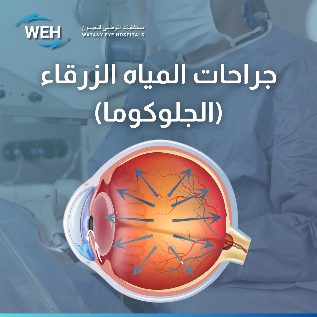 عملية المياه الزرقاء